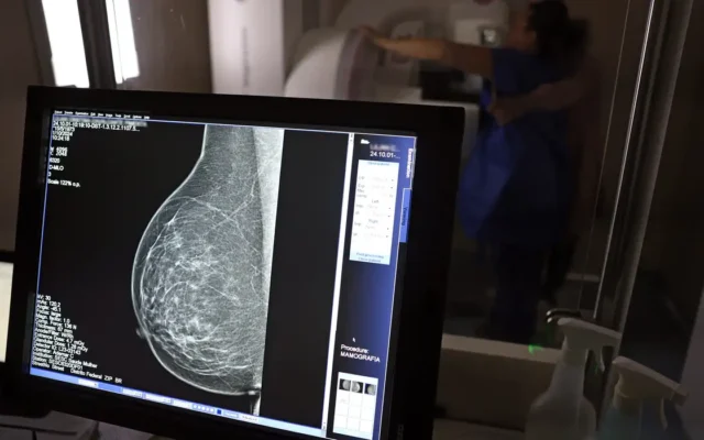 Brasília (DF), 01/10/2024 - Teste de mamografia realizado na Campanha Outubro Rosa: Sesc-DF, que oferece exames e consultas gratuitas às mulheres. Foto: José Cruz/Agência Brasil